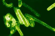 Вирус лихорадки Эбола под микроскопом.