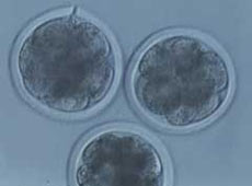 Клонированные человеческие эмбрионы (фото clonaid.ru).