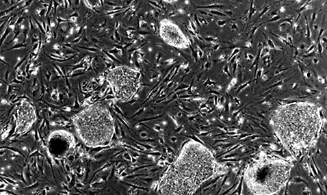 Так под микроскопом выглядит колония эмбриональных стволовых клеток человека (фото rso.cornell.edu).