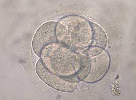 Клонированный эмбрион человека из 8 клеток. У корейцев клеток, в конечном счёте, было 100 (фото W.S. Hwang)<!-- SP1626D331 -->.
