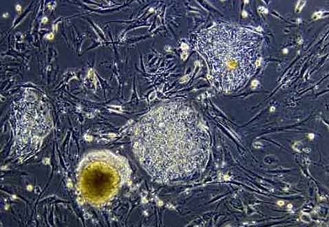 Колония недифференцированных эмбриональных стволовых клеток человека при 10-кратном увеличении (фото Univ. of Wisc.-Madison/Reuters)<!-- SP1626D331 -->.