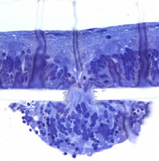 Разрез под микроскопом: клетки сетчатки крысы мигрируют через крошечное отверстие имплантата (фото с сайта stanford.edu).