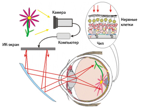 Бионический глаз Паланкера (иллюстрация с сайта stanford.edu).