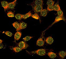 Этот снимок не имеющих отношения к рассматриваемому исследованию гепатоцитов мы выбрали потому, что он один из самых красивых (фото с сайта vigicell.fr)<!-- SP1626D331 -->.