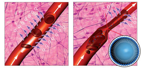 Слева: нормальный сосуд и красные кровяные клетки в нём. Справа: повреждённый участок. Синий шарик на врезке и синие точки на рисунке — частицы эмульсии препарата Oxycyte, несущие кислород (иллюстрация Paul Wootton)<!-- SP1626D331 -->.